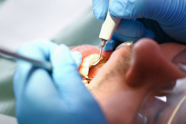 Best Emergency Tooth Extraction  in Cambridge, NE