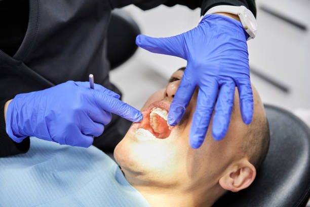 Best Dentist for Tooth Abscess  in Cambridge, NE