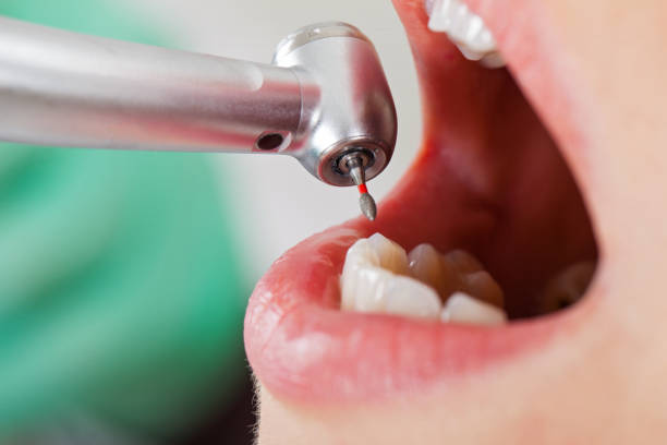 Best Tooth Infection Emergency Dentist  in Cambridge, NE
